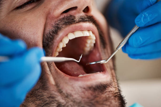 Best Emergency Root Canal Treatment in Waterville, ME